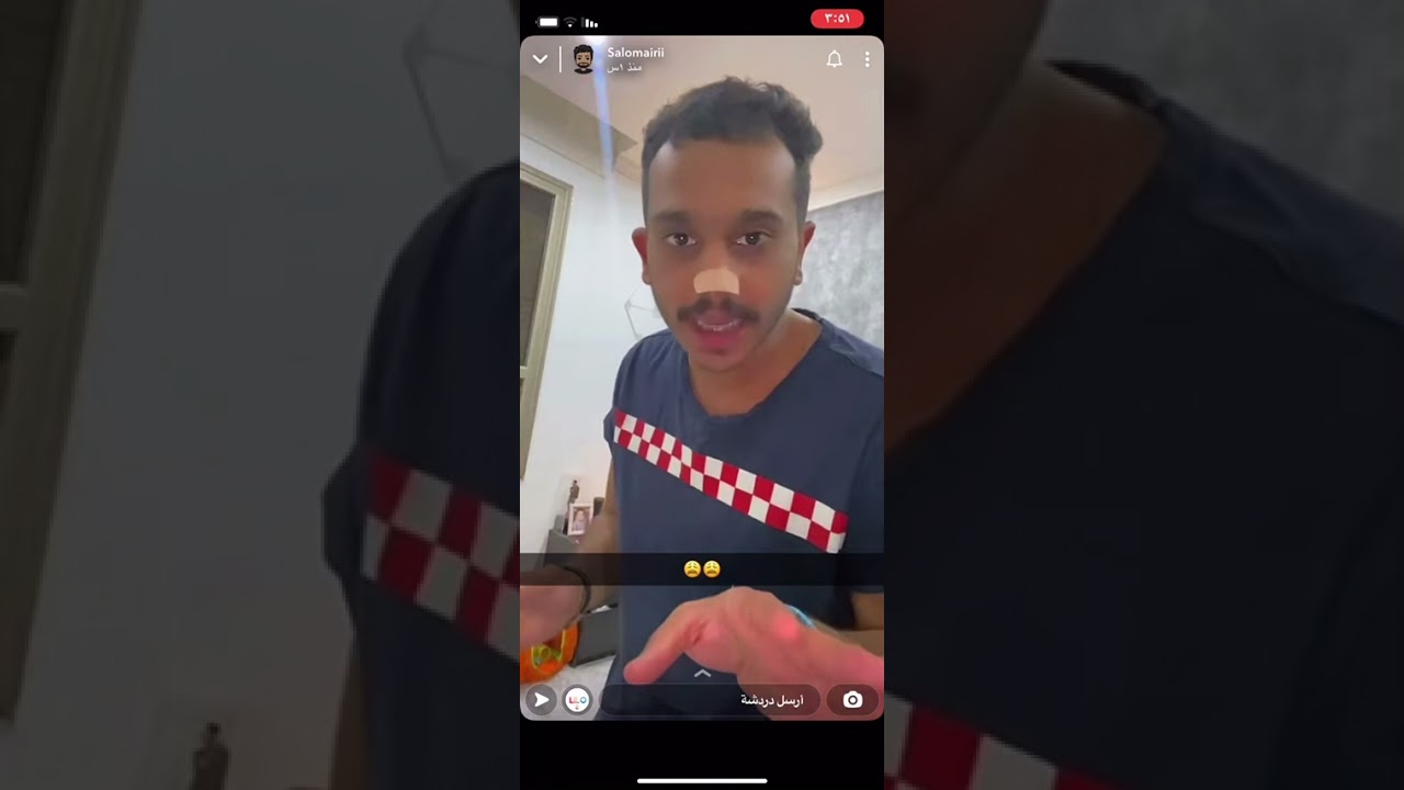 سنابات شملان العميري| سپاچه جرحت شملان😭😭