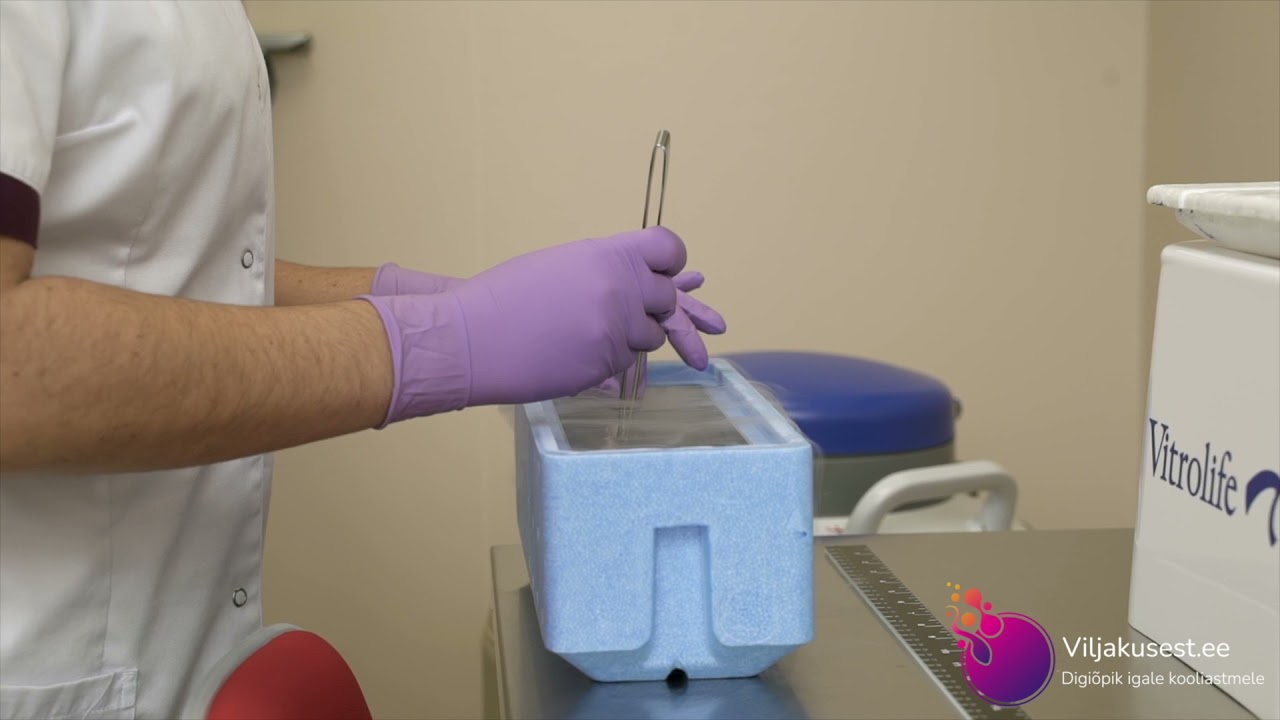 FET - Frozen Emryo Transfer - külmutatud embrüo (emakasse) siirdamine - Dr Peeter Karits