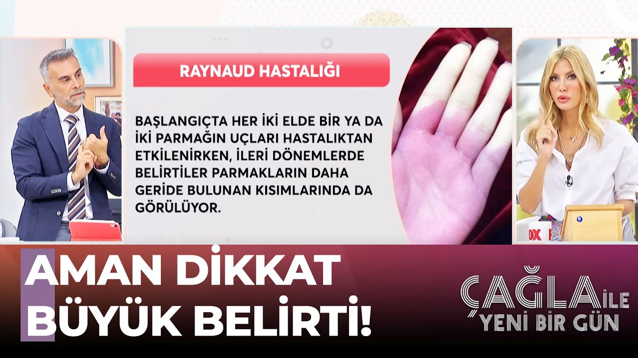 Soğuktan Morarıyorsa Hastalık Belirtisi! - Çağla ile  Yeni Bir Gün 909. Bölüm