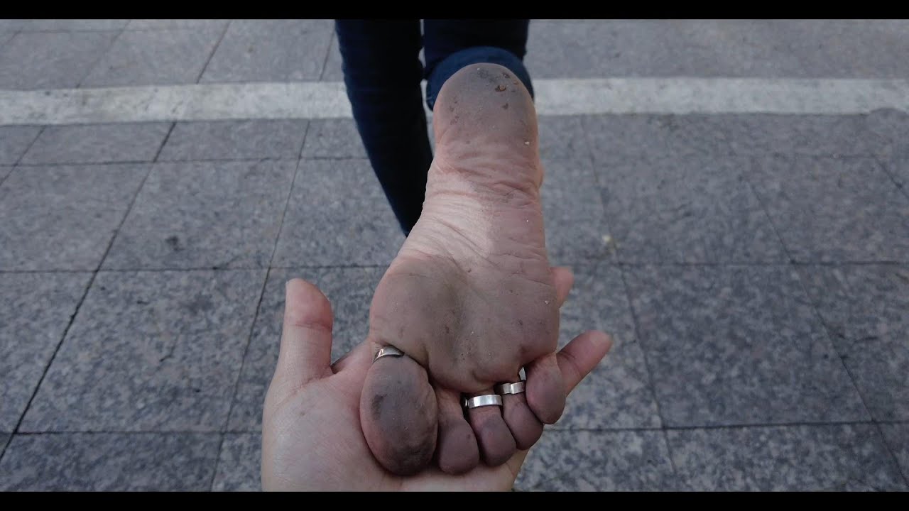 Tuan shows off dirty soles after a barefoot walk