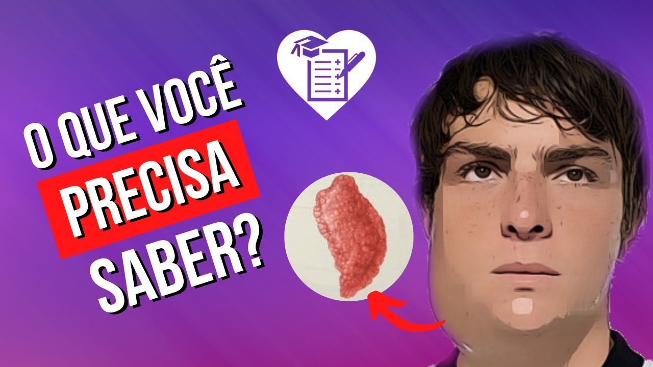 CAXUMBA - Causas, Sintomas, Tratamento, Diagn&oacute;stico e Preven&ccedil;&atilde;o