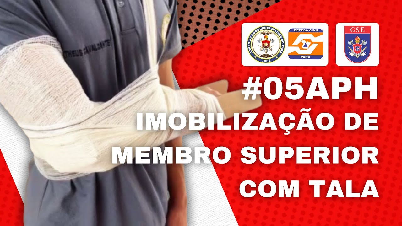 IMOBILIZAÇÃO DE MEMBRO SUPERIOR COM TALA #05APH