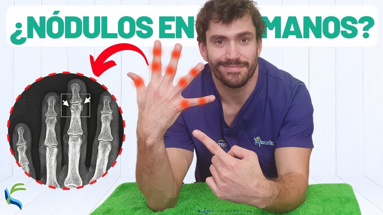 ШАРИКИ НА ПАЛЬЦАХ РУК🖐😫? 5 упражнений, которые ИСЦЕЛЯЮТ ИХ.