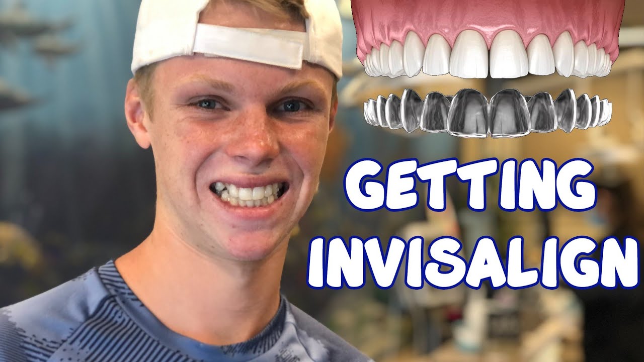 Getting INVISALIGN for Teens PART 2 - Picking Up the Aligners