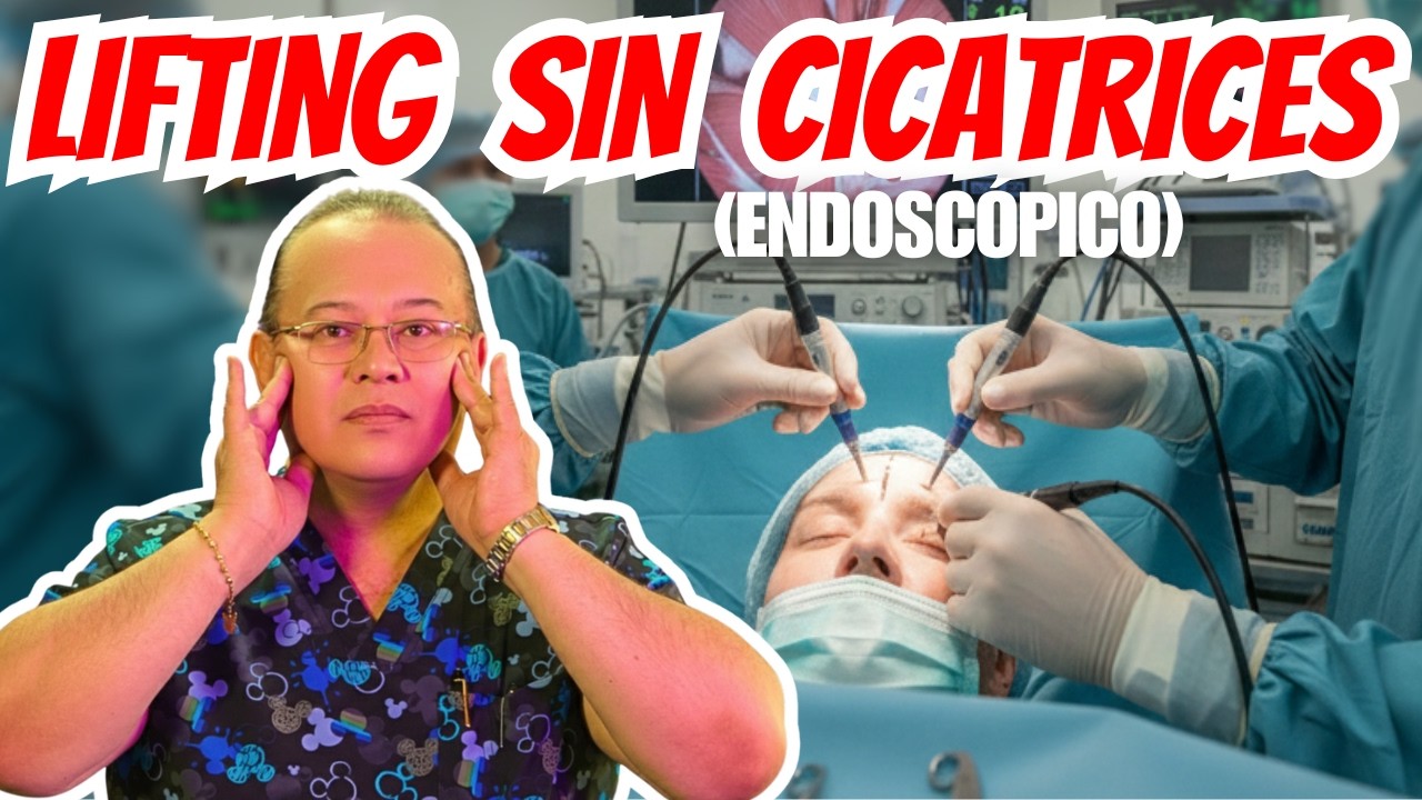 Rejuvenecimiento Facial sin cicatrices visibles I Lifting Endoscópico