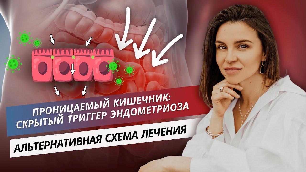 Проницаемый кишечник - скрытый триггер эндометриоза. Альтернативная схема лечения.