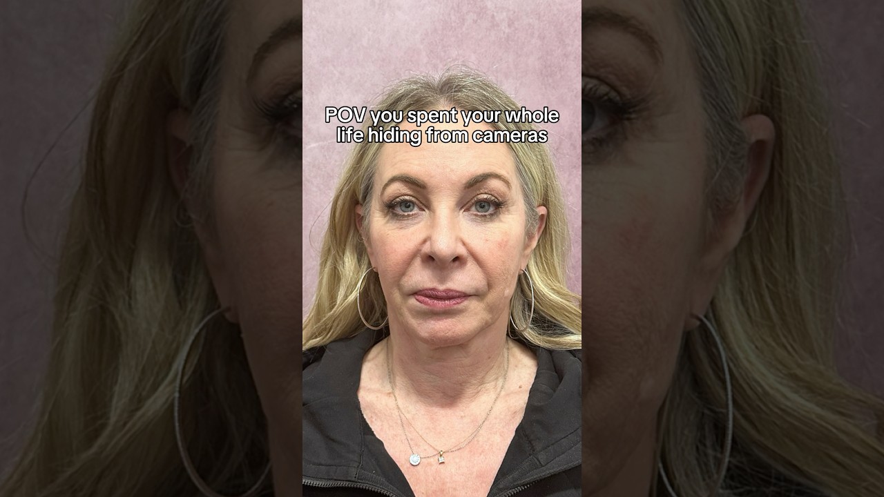 She Can&rsquo;t Stop Taking Selfies After Having a Full Face Rejuvenation! 🥹