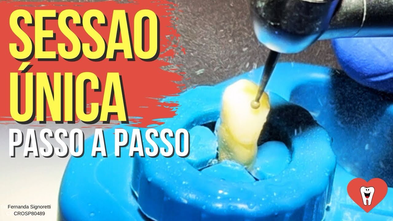 ENDODONTIA CANINO SUPERIOR: RECIPROC NÃO DESCE? - ENDOLOVERS