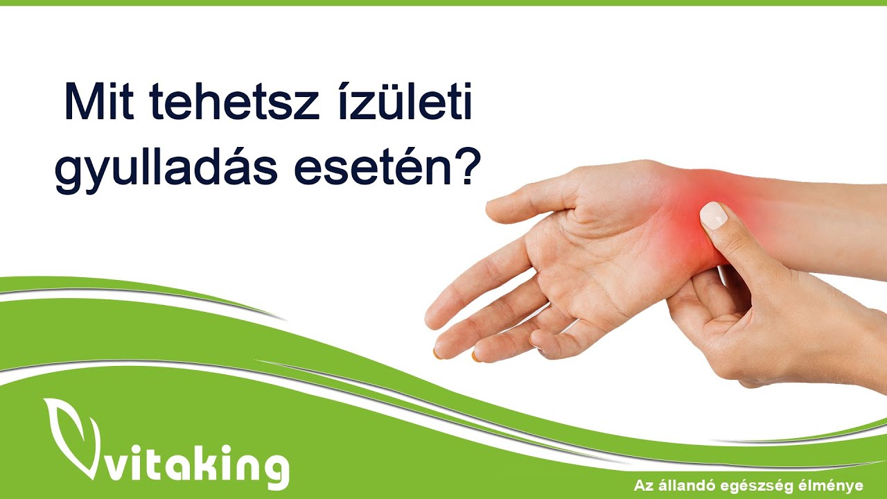 Ízületi gyulladás esetén ezek a hatóanyagok segíthetnek!