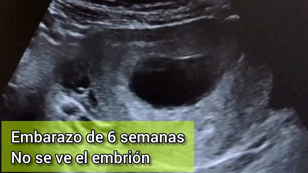 Dr.Bernardo Velasco está en vivo
