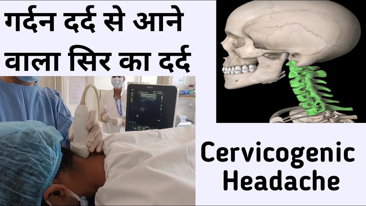 Cervicogenic headache II गर्दन दर्द से आने वाला सिर का दर्द II Pain management Dr. Aanchal Sharma