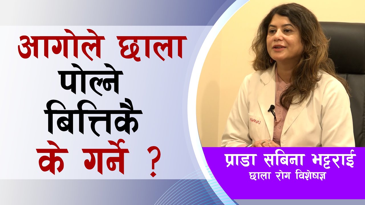 आगोले छाला पोल्ने बित्तिकै के गर्ने ? ॥ Dr Sabina Bhattrai ॥ Health Tips ॥ swasthyakhabar ॥