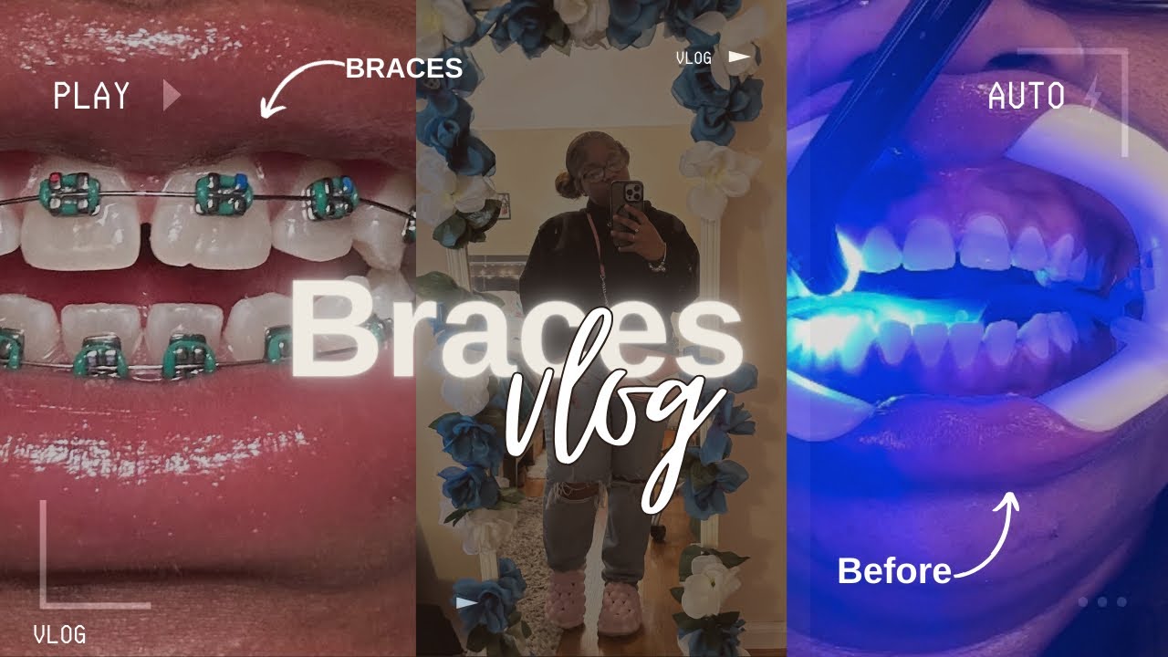 GETTING BRACES🦷|| WINTER VLOG❄️….Pain 10/10. Lashay Ayana