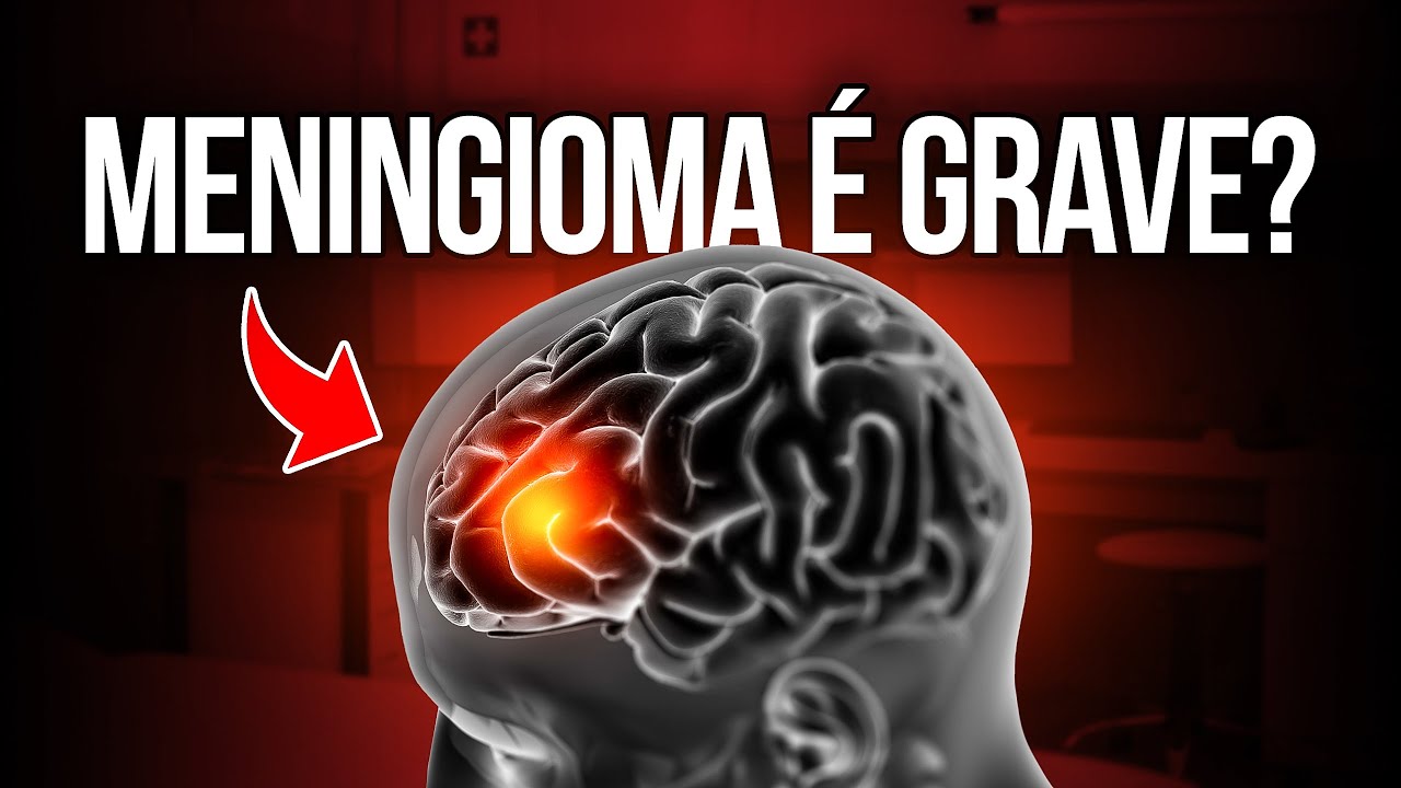Meningioma Cerebral