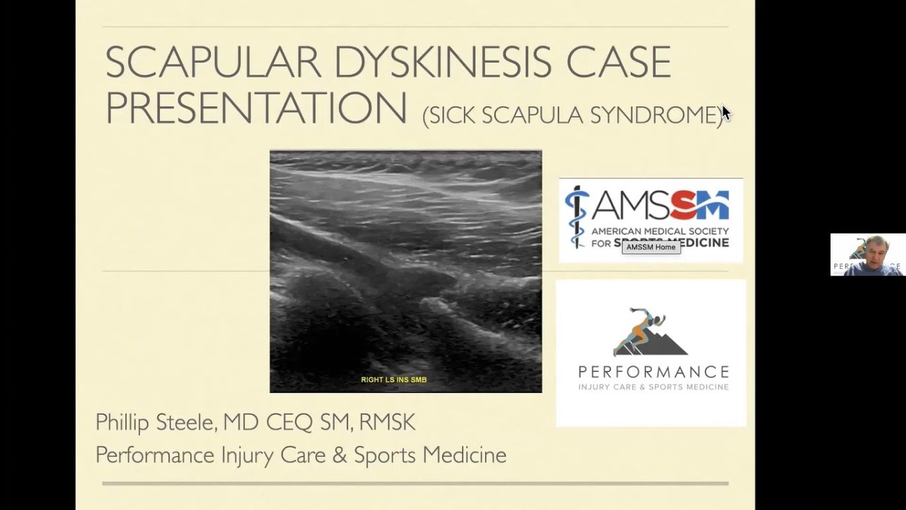 Scapular Dyskinesis with Dr. Phillip Steele | AMSSM Sports Ultrasound Case Presentation