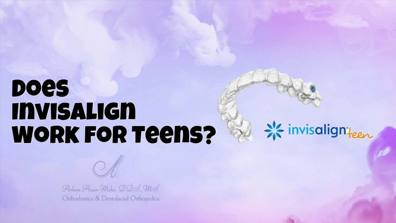 Does Invisalign Work for Teens? | Dr. Arleen Azar-Mehr Orthodontics