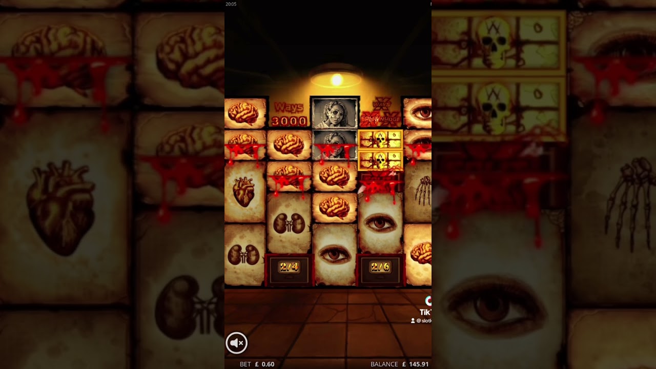 Big Base Game Win on Mental #casino #fun #gambling #slot #mental