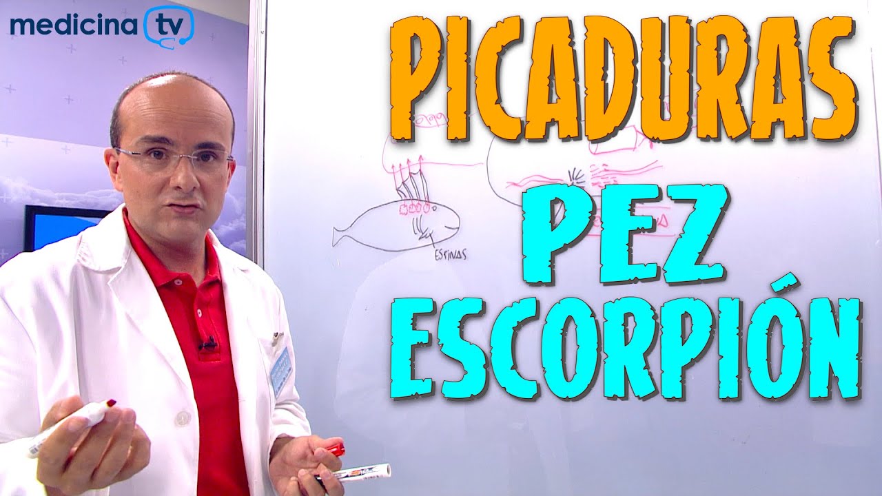 PICADURA DE PEZ ESCORPIÓN, ¿Cómo es? ¿Qué síntomas producen? ¿Cómo hay que actuar?