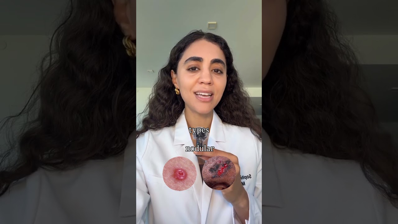 Learn how to find your own skin cancer (part 1): basal cell carcinoma