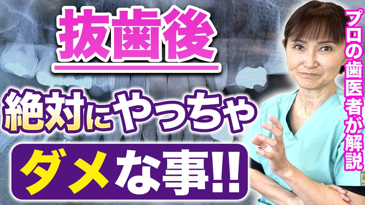 抜歯後、腫れ・痛みの原因はコレ！やっちゃいけない「NG行動」をプロの歯医者が解説します。