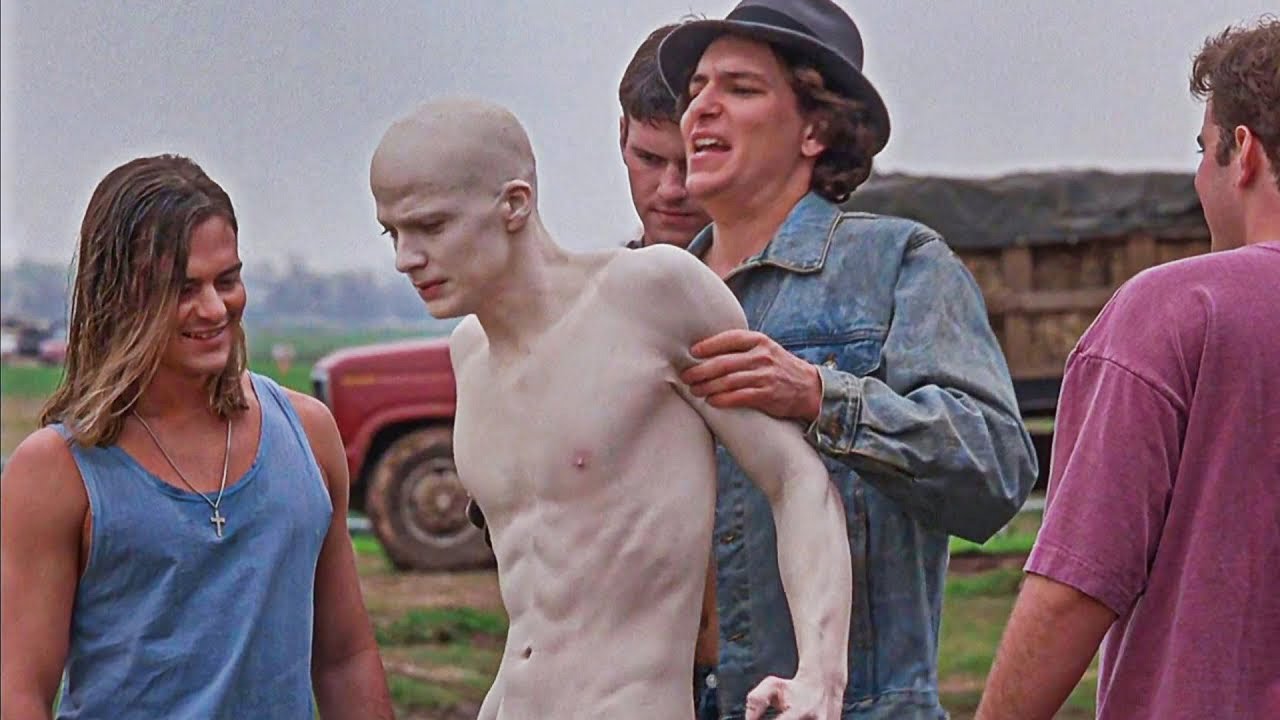 They Bully This Albino Guy, Unaware He&rsquo;s A Rare-Disorder With Something Special | Movie Recap