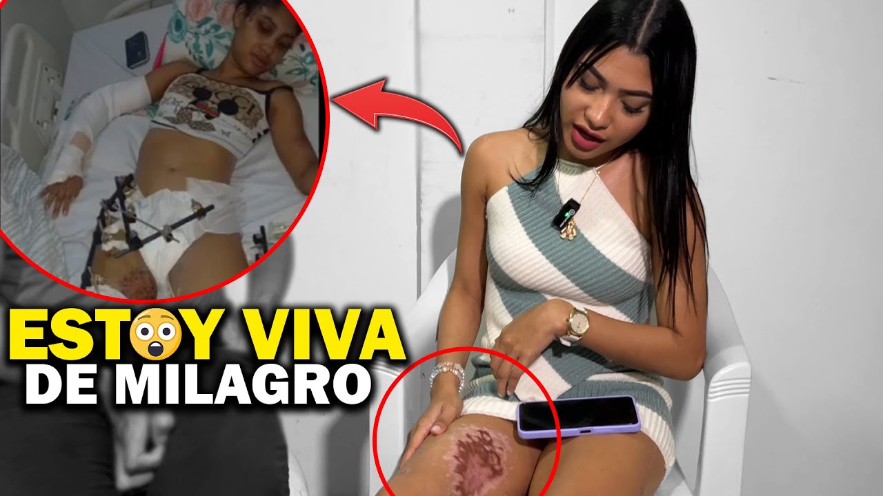 VIVIÓ PARA CONTARLO  😱 UN CAMIÓN LA ARROLL0 Y POR POCO PIERDE LA VIDA 😯
