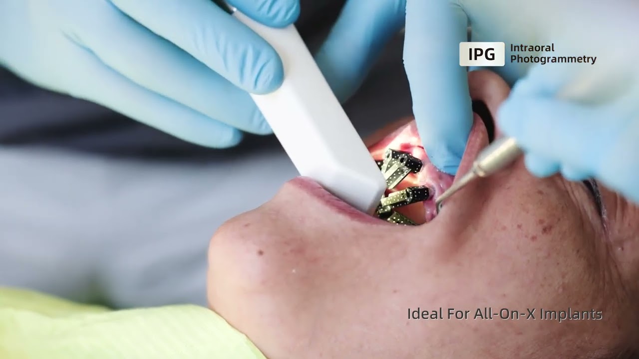 Aoralscan Elite - IPG (Fotogrammetria Intraorale) Scanner di SHINING 3D Dental