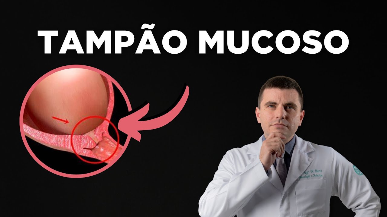 TAMPÃO MUCOSO: O que Você PRECISA Saber