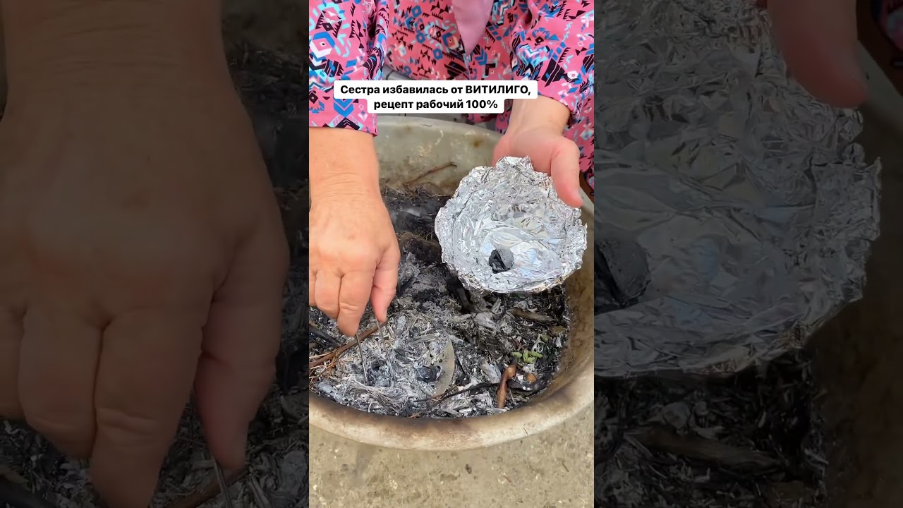 Я знаю точно, что витилиго лечится!!! ПОДПИШИСЬ НА МЕНЯ, Я РАССКАЖУ КАК