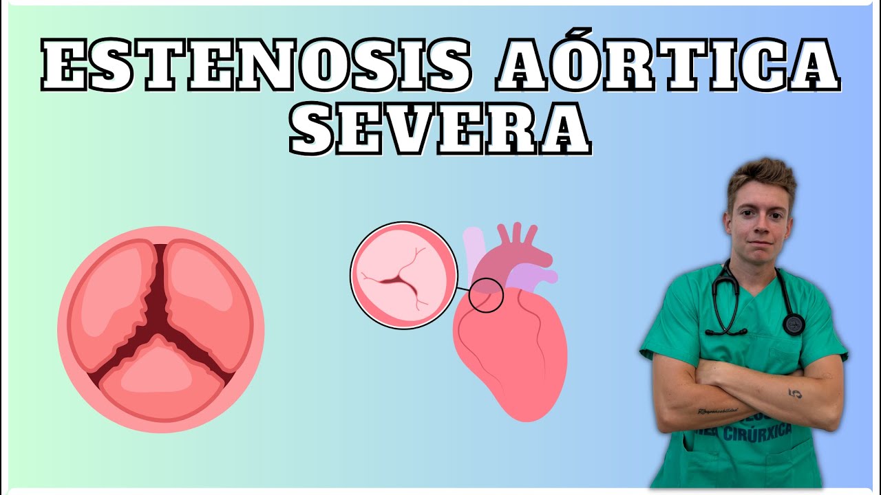 Entendiendo la estenosis aórtica severa (Videopodcast)