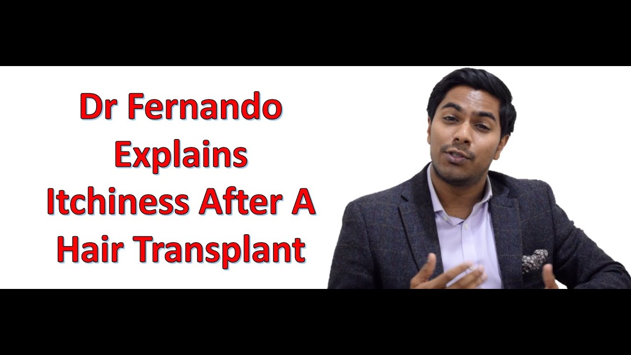 Are You Itching After An FUE Hair Transplant?