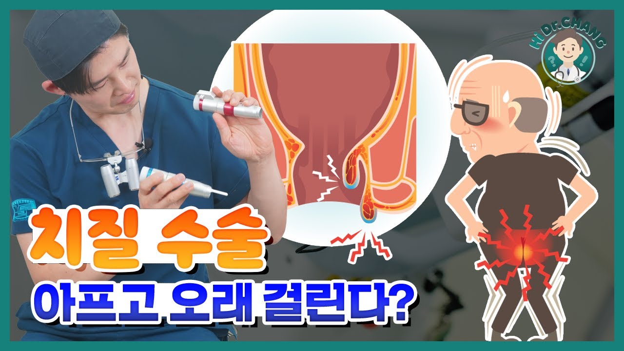 치질 수술, 아프고 오래 걸린다? 비절개 레이저 수술로 바뀌었습니다!