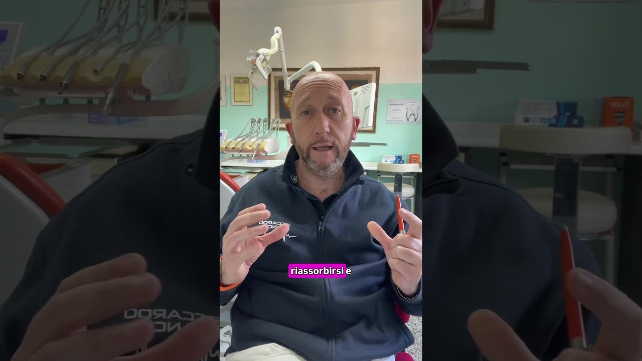 Impianti: perché fanno la differenza?🤔