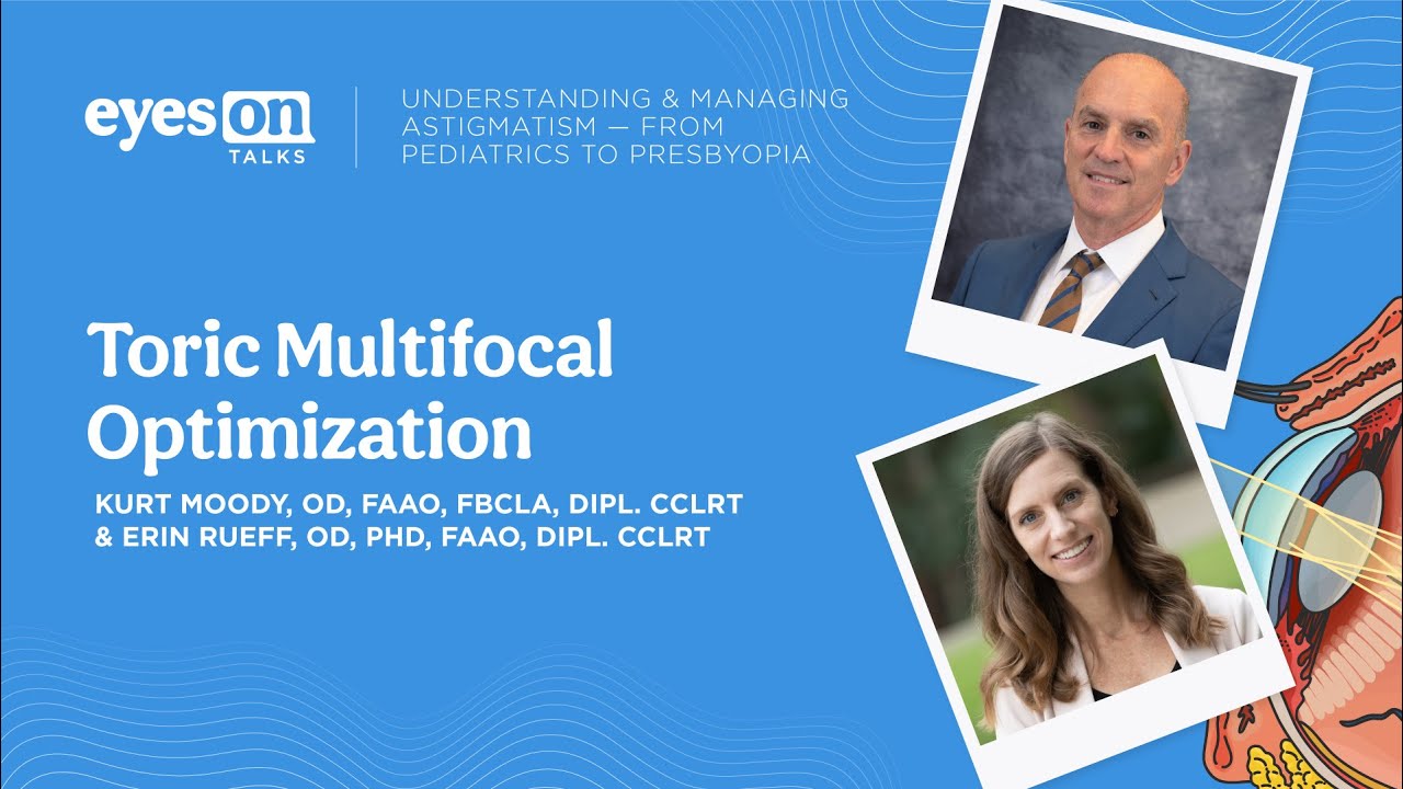 Understanding & Managing Astigmatism Series: Toric Multifocal Optimization