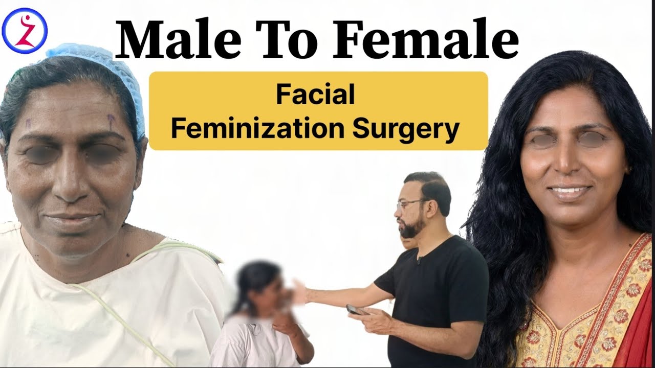 Facial Feminization Surgery In India | Cost Of Facial Feminization Surgery In India | Zenith Clinic