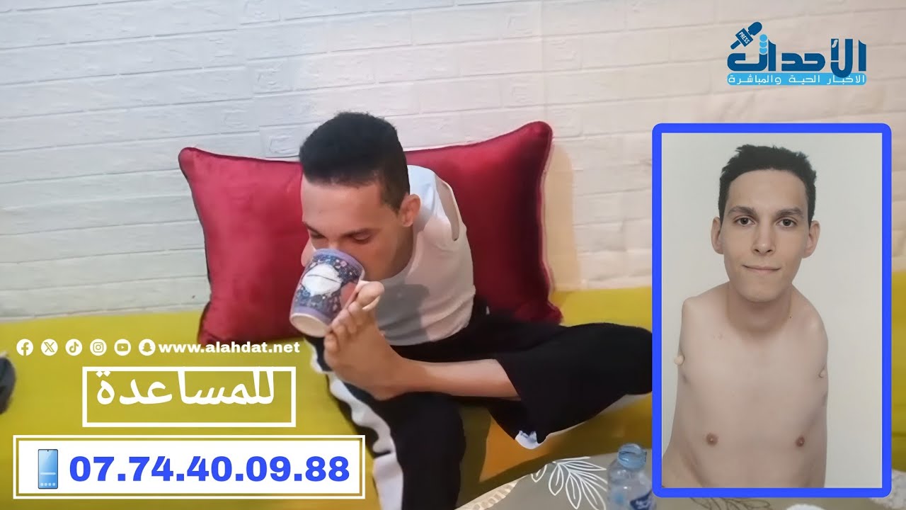رسالة مؤثـ ـرة..أيوب شاب ازداد بدون يدين يناشد المغاربة بعد 22 سنة من المعاناة وبغا صوتو يوصل الملك 
