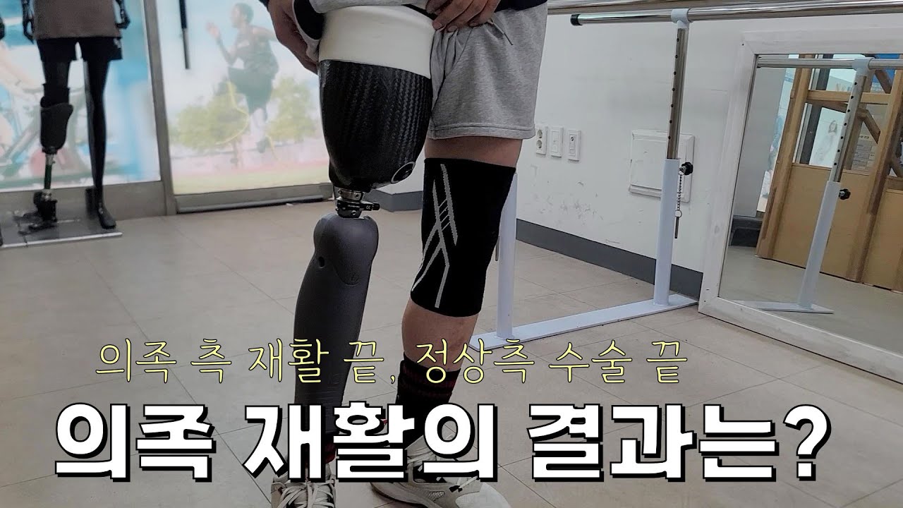 의족측 재활 끝, 정상측 마지막 수술 : 의족 재활의 결과는?