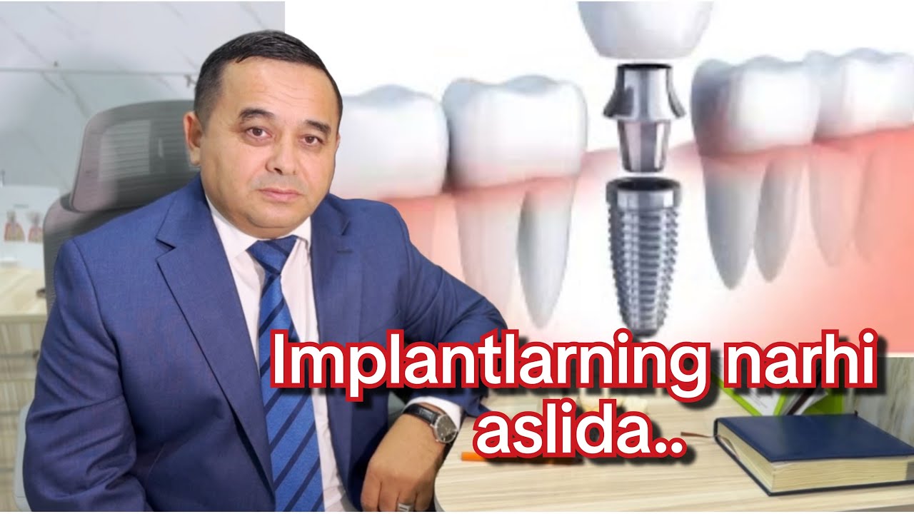 Implantlarniing aslida narhi.. Doktor Shavkat Stom oshkor etadi..