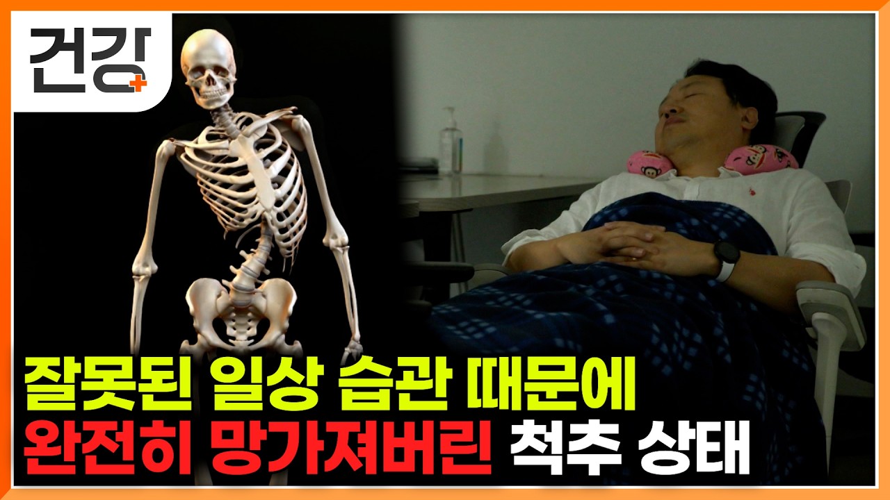 나도 모르게 다리 꼬고, 이상하게 앉았던 행동들이 척추측만증이 되어 돌아왔다｜척추측만증 집에서 수술 없이 고치는 법｜귀하신 몸｜#EBS건강