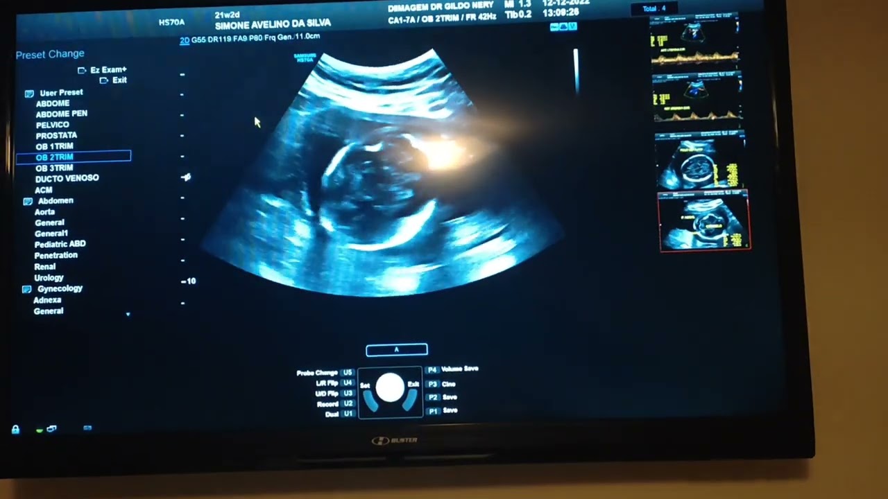 NOSSO BB O QUE SER&Aacute;? MENINO  OU MENINA ? VEJA O VIDEO AT&Eacute; O FINAL E DESCUBRA.
