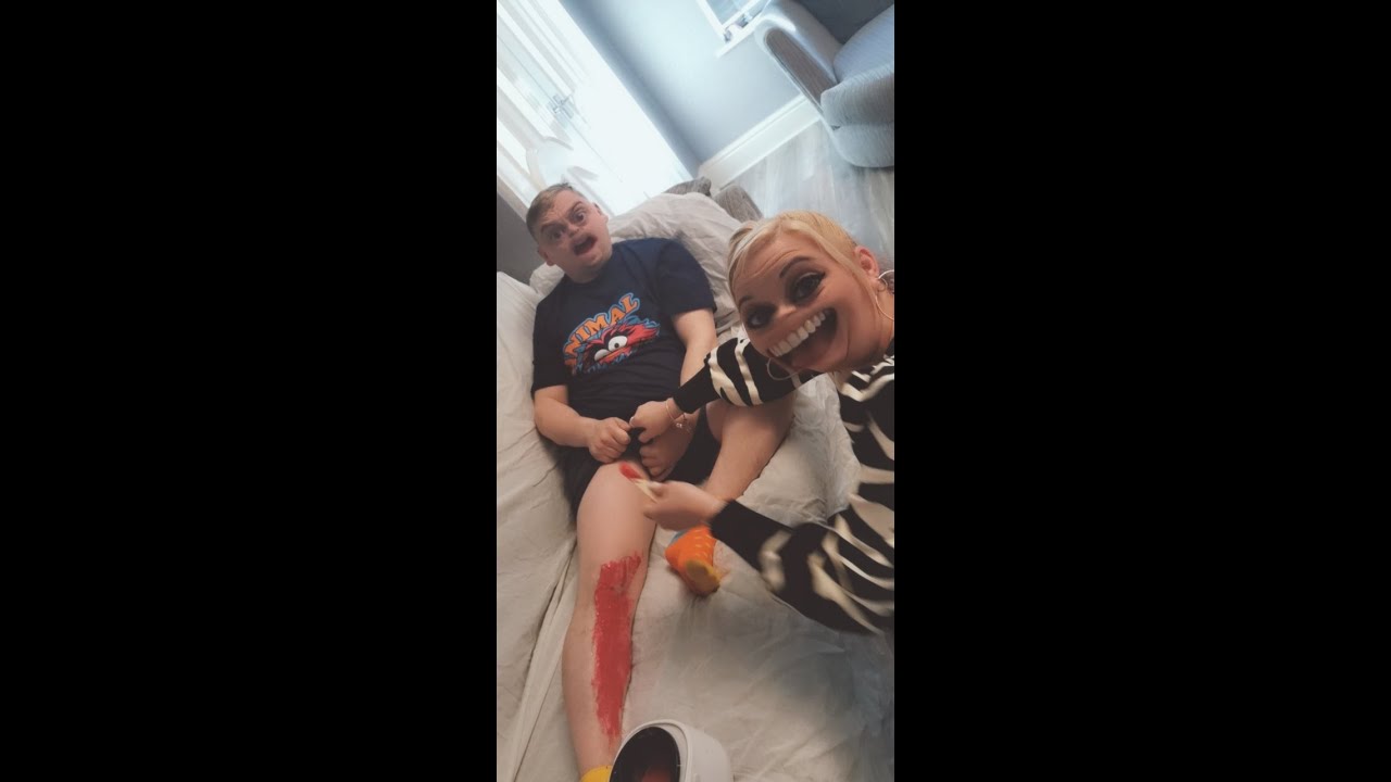 Hot Leg Wax Gone Wrong