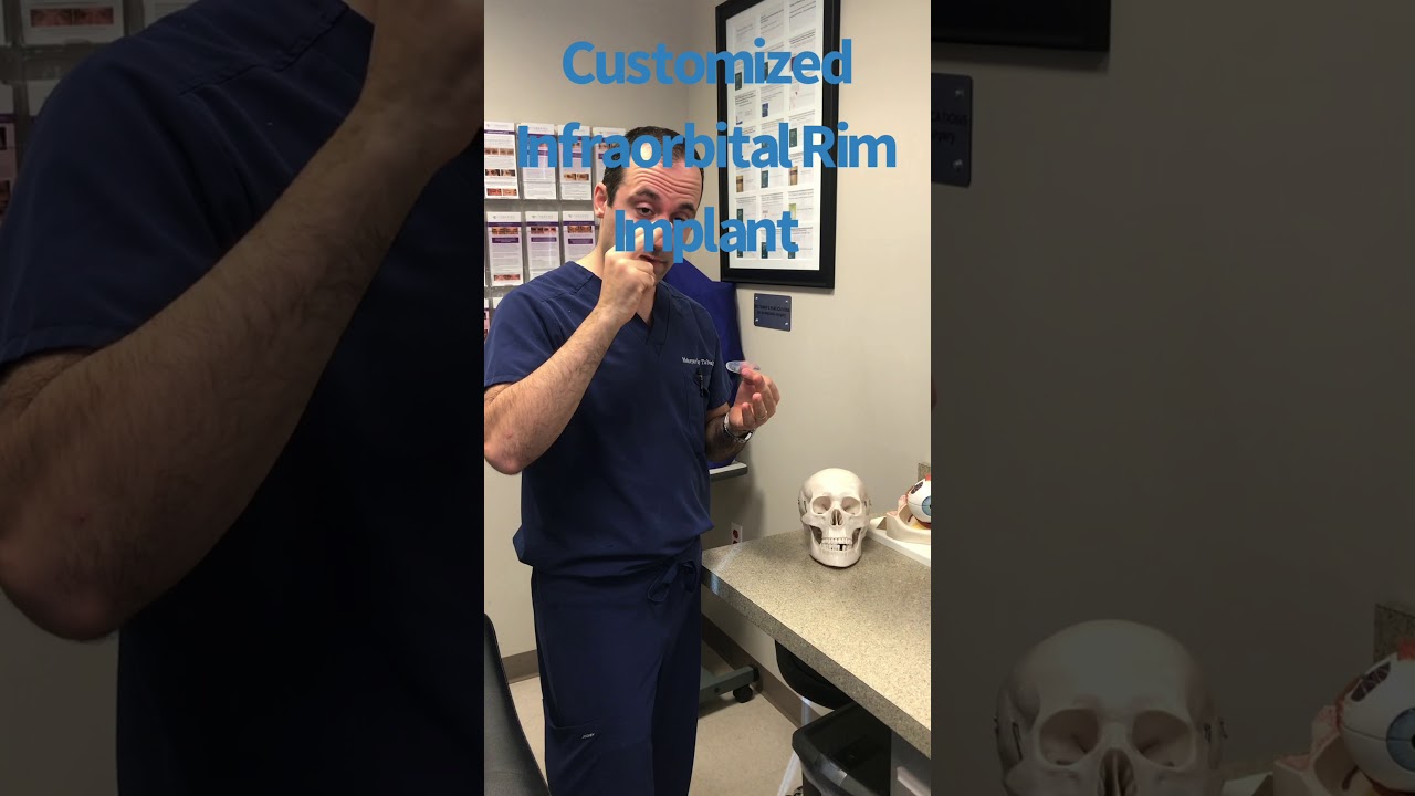 Customized Infraorbital Rim Implant-- Dr. Mehryar Taban-- CALL 310-299-8313