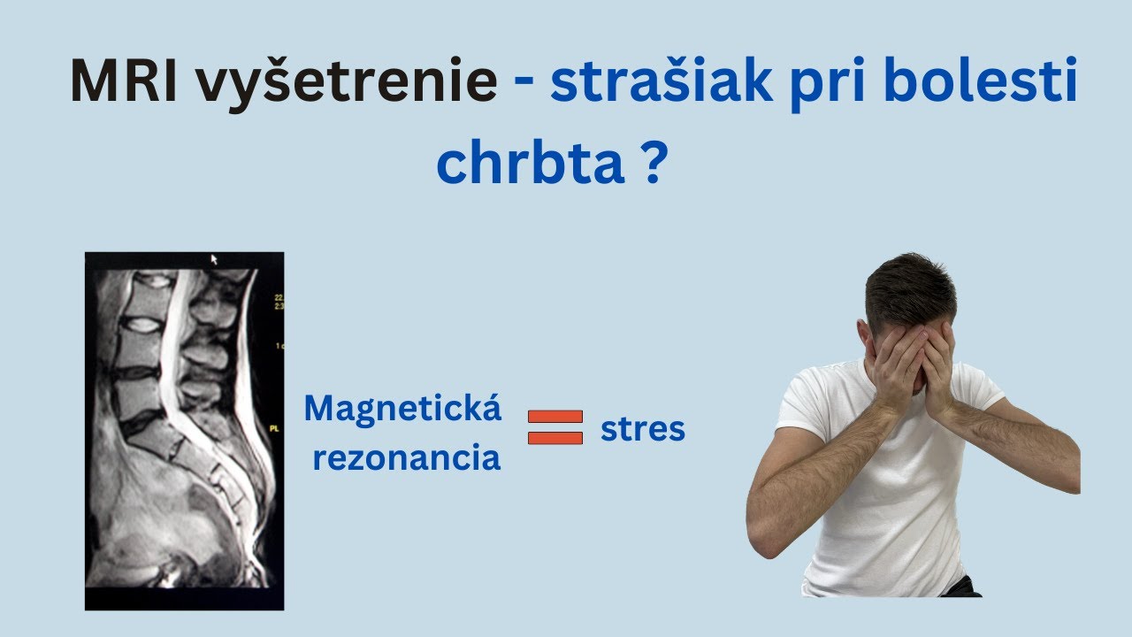 Vysledok z magnetickej rezonancie nemusí byť taký zlý, ako si myslíte 😲