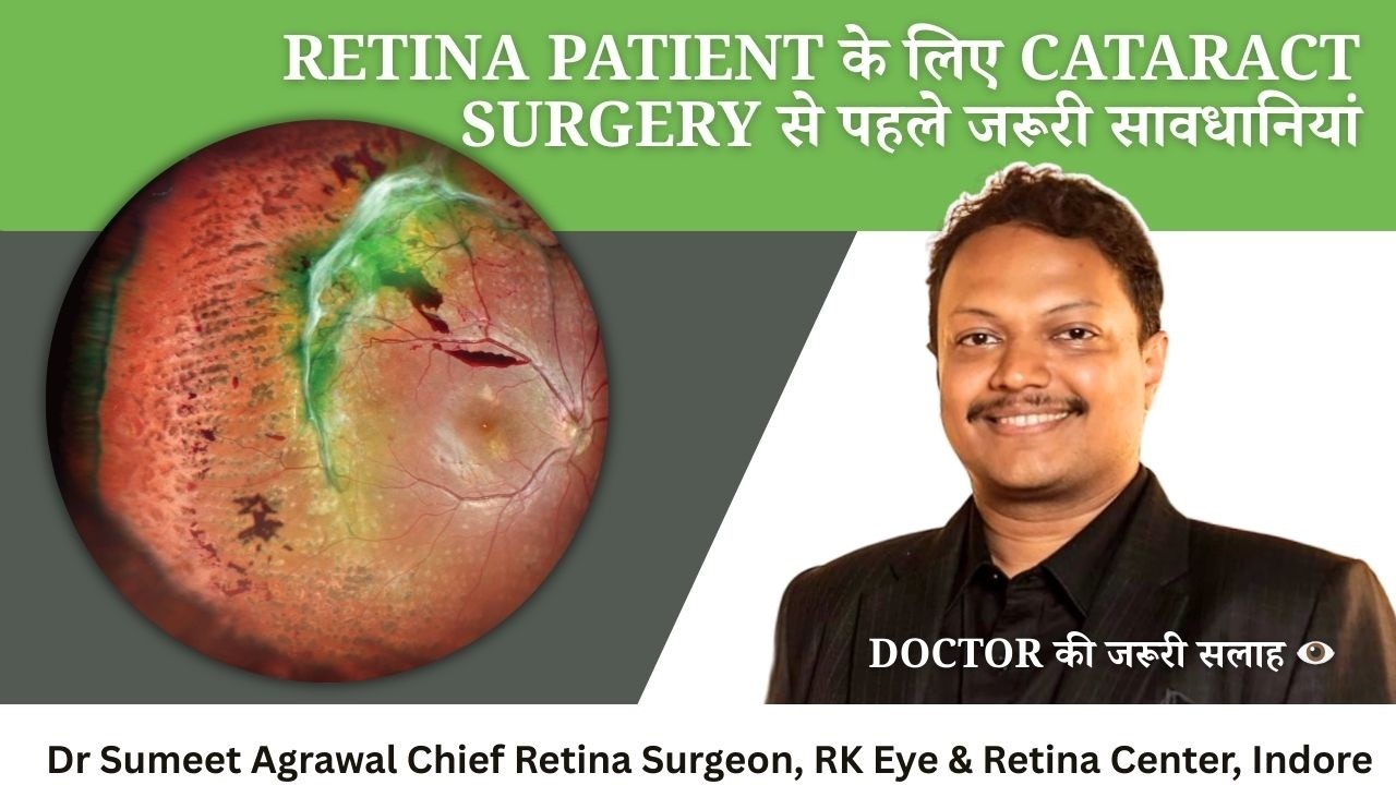 Retina ki बीमारी है और Cataract Surgery करानी है ? —इन बातों का रखें विशेष ध्यान !