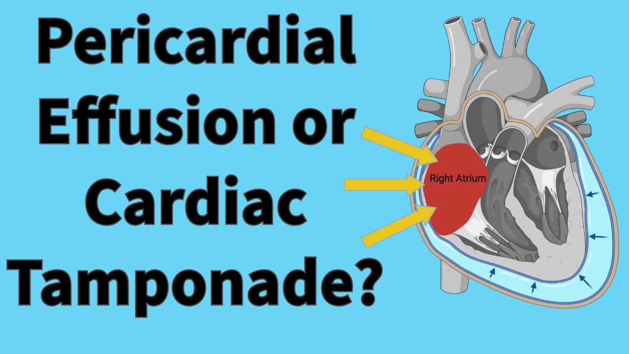Could It Be Cardiac Tamponade? What Echo Won’t Tell You Without This Key Insight in Dogs and Cats