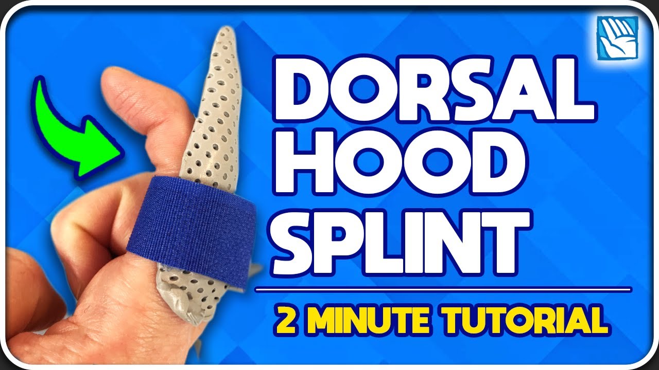 How to Make a Dorsal Hood Splint in Under 2 Minutes
