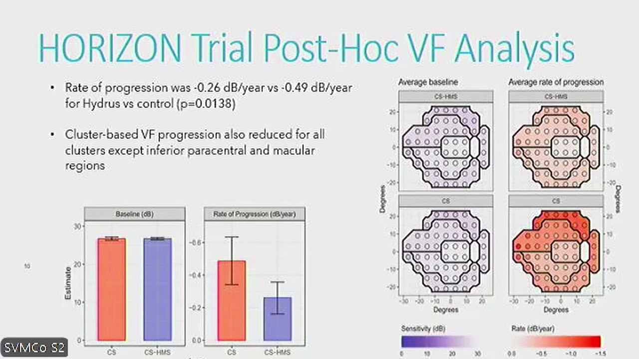 Interventional Glaucoma and Advancements in MIGS By Dr. O. Smith and Dr. M. Shah