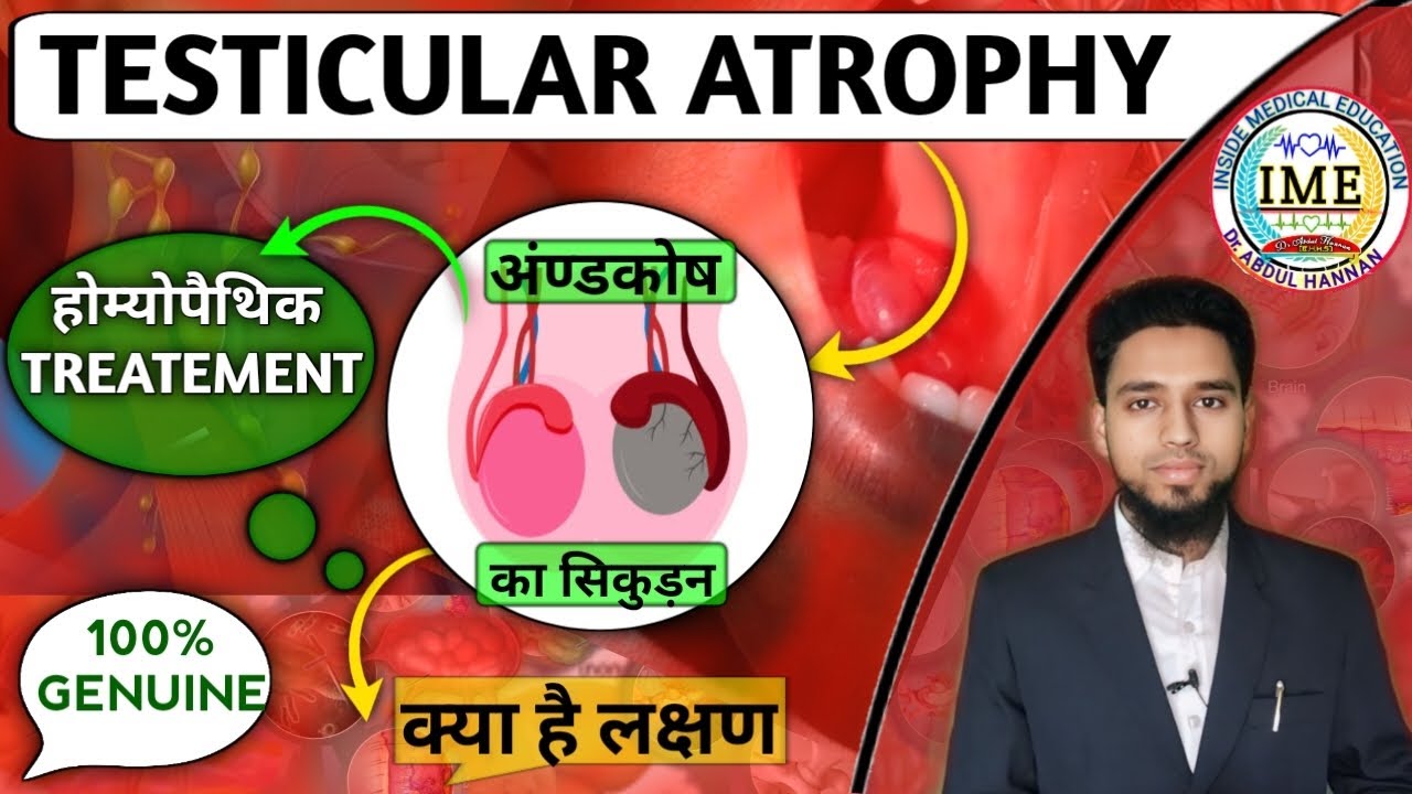 TESTICULAR Atrophy|| अंण्डकोश के सिकुड़न की समस्या || Homoeopathic medicine for TESTICULAR Atrophy