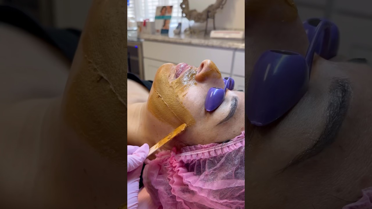 Reve Enlighten Depigmentation Peel|Discoloration|Acne Blemishes #skincare