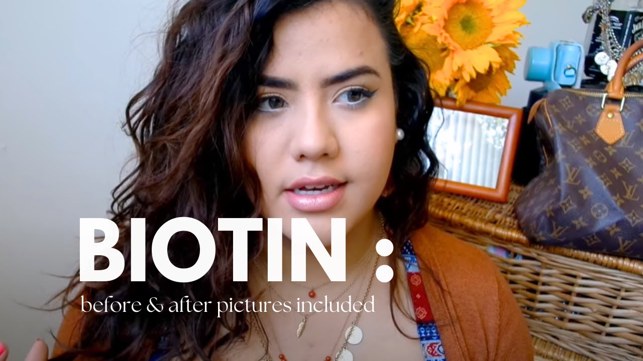 1 YEAR BIOTIN HAIR GROWTH REVIEW: BEFORE & AFTER